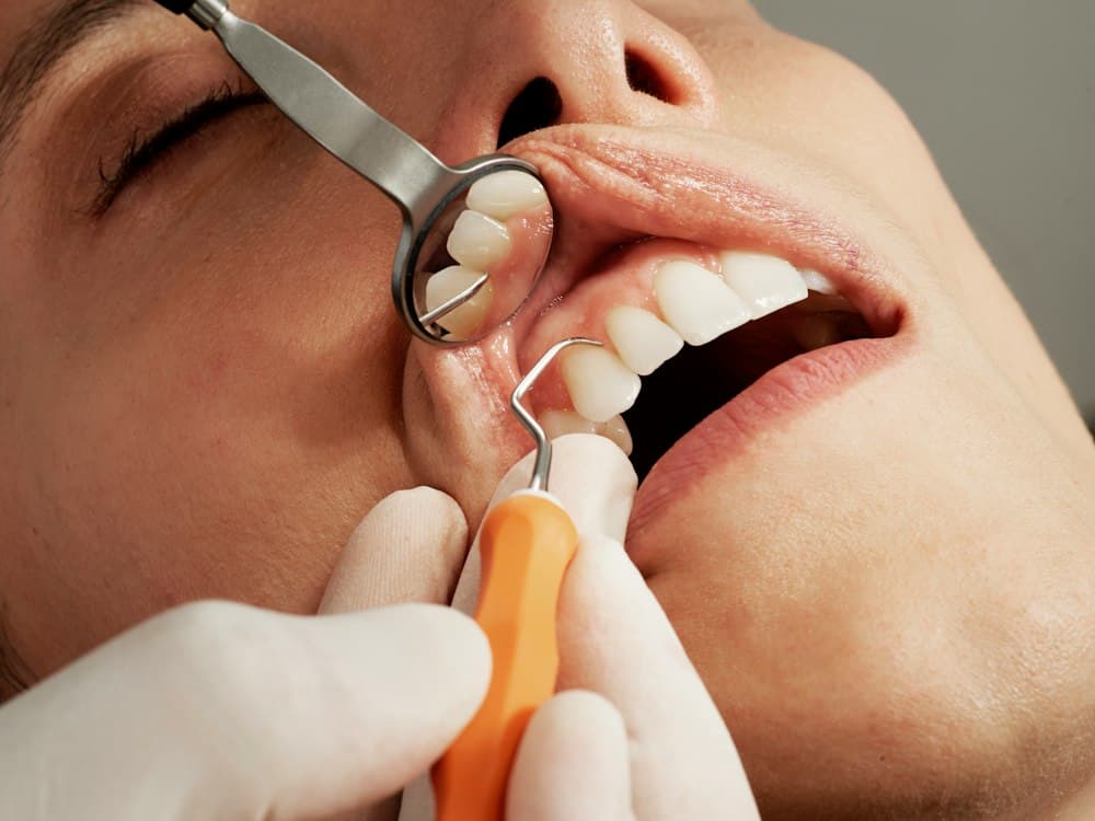 Dental checkup